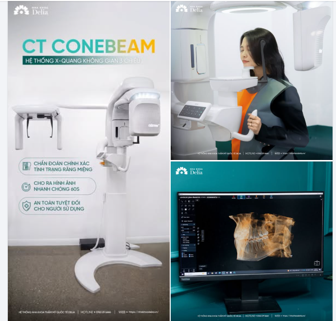 CÔNG NGHỆ CT CONEBEAM: CHẨN ĐOÁN HÌNH ẢNH CHÍNH XÁC - NHANH CHÓNG - AN TOÀN