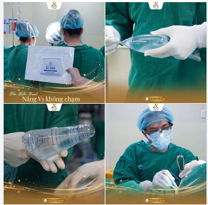 NÂNG VÒNG 1 – TẠI SAO BÁC SĨ KỲ SỬ DỤNG PHỄU?