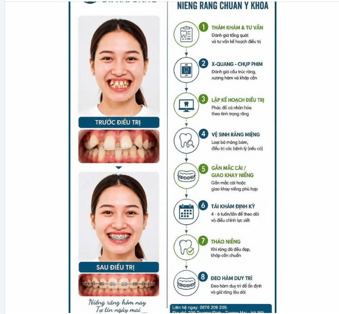 NIỀNG RĂNG CHUẨN Y KHOA – THAY ĐỔI NỤ CƯỜI - TỰ TIN NGÀY MAI