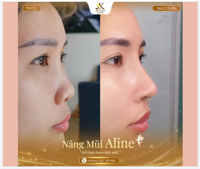 Không cần một dáng mũi quá cao hay quá sắc nét.