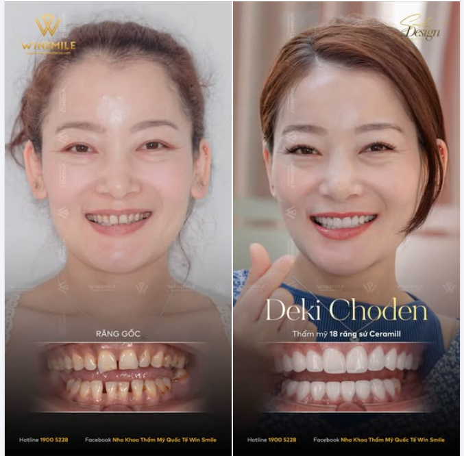 TRAO ĐI SỰ CHĂM SÓC CHO HÀNG NGÀN NGƯỜI, NHƯNG LẠI BỎ QUÊN NỤ CƯỜI CỦA CHÍNH MÌNH