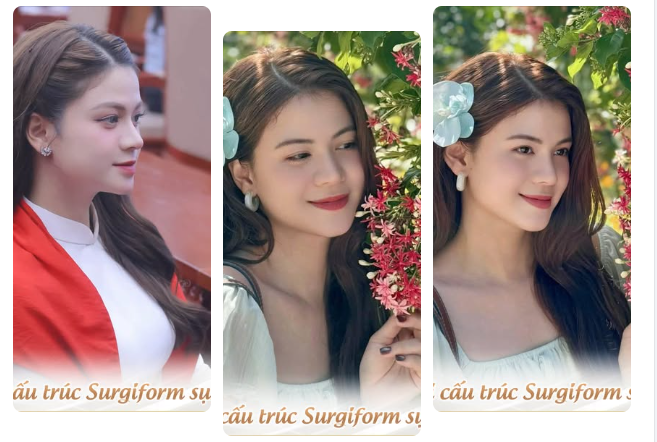 Nhìn lại hành trình 8 năm cùng dáng mũi cấu trúc BARBIE-LINE của Quý Cô
