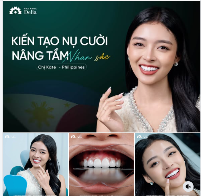NỤ CƯỜI MỚI – HÀNH TRÌNH MỚI CÙNG NHA KHOA DELIA