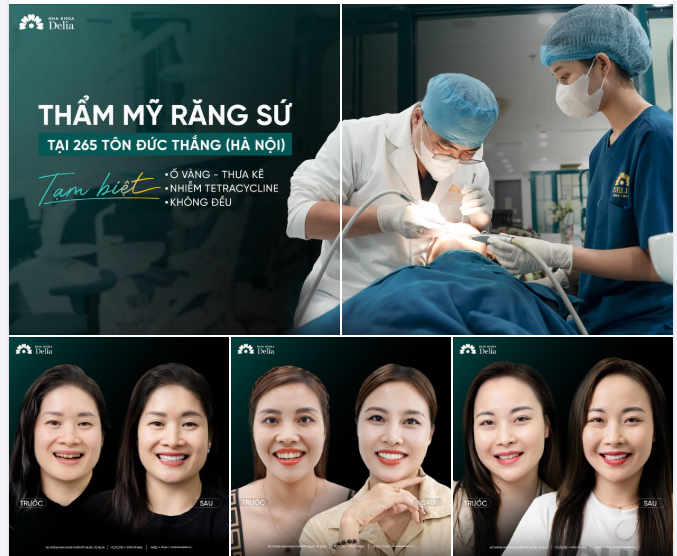 LỰA CHỌN DELIA — LỰA CHỌN SỰ AN TÂM CHO NỤ CƯỜI KHỎE ĐẸP TỰ TIN!