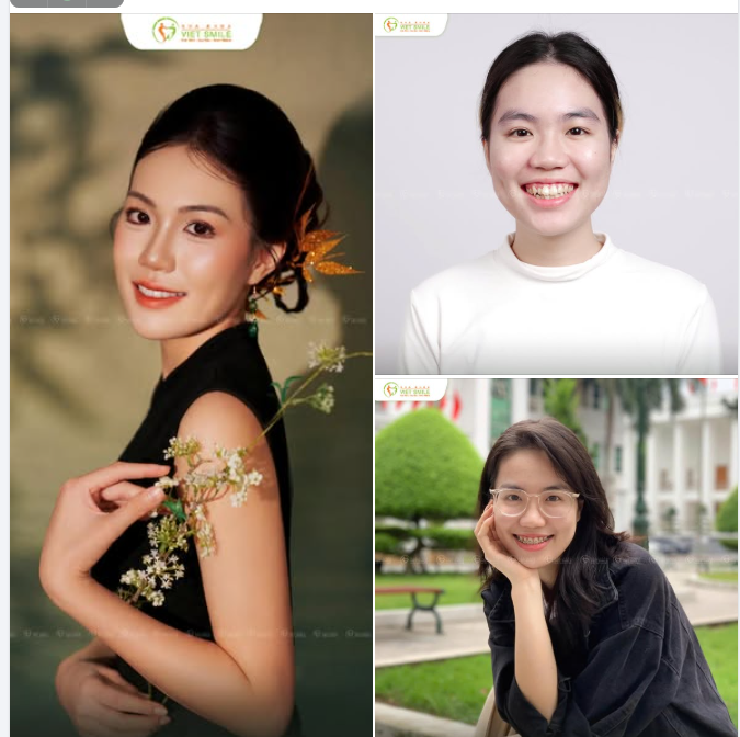 TRAO NIỀM TIN – GỬI NỤ CƯỜI TẠI VIET SMILE