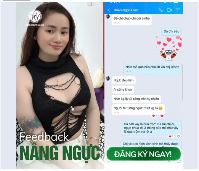 "Người ta tưởng ngực thiệt không á" - Câu khen mát lòng mát rưởi nhất mà chị khách gửi về cho Bệnh Viện Thẩm Mỹ Ngô Mộng Hùng đây ạ!