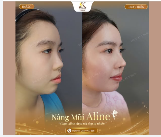 GÓC NGHIÊNG THAY ĐỔI – TỰ TIN TỎA SÁNG SAU 2 TUẦN