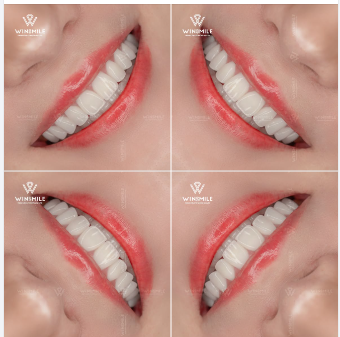 Có bao giờ bạn ngắm nhìn một nụ cười và cảm thấy rất dễ chịu, nhưng lại khó gọi tên chính xác điều gì đã tạo nên sự cuốn hút đó?
