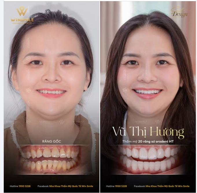 "Mình làm mà không ai biết mình làm"