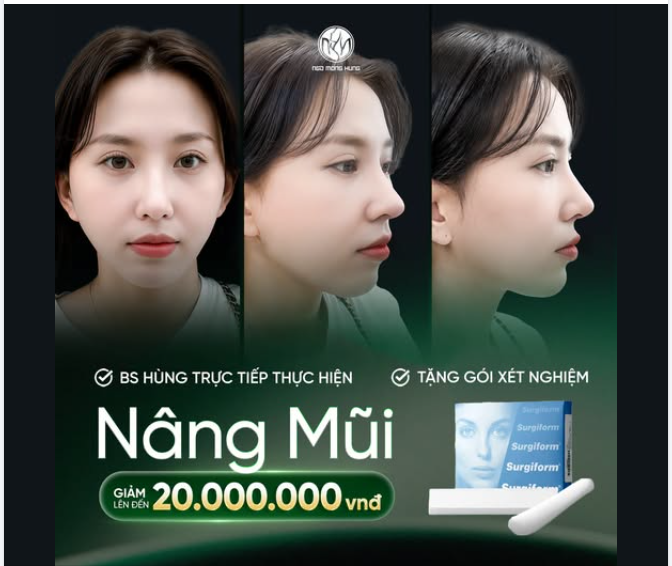 Nâng mũi xong, góc nào cũng phải đẹp!   Nâng mũi tiết kiệm đến 20TR