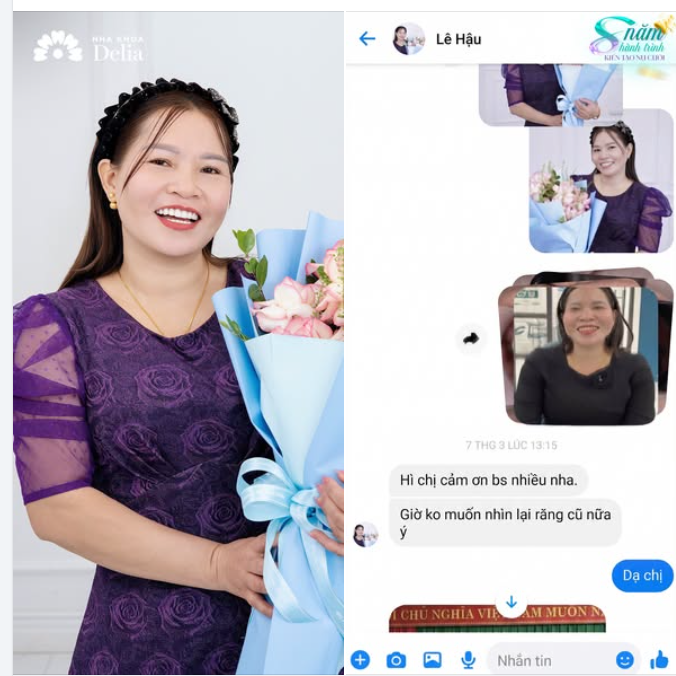"Chị cảm ơn bác sĩ nhiều nha. Bây giờ không muốn nhìn lại răng cũ nữa ý!"