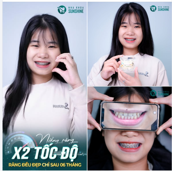 "BẠN CÓ ĐANG CÓ THÓI QUEN LẤY TAY CHE MIỆNG MỖI KHI CƯỜI LỚN?"