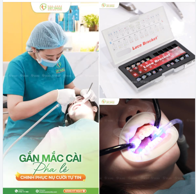 GẮN MẮC CÀI PHA LÊ – BẮT ĐẦU HÀNH TRÌNH ĐÓN NỤ CƯỜI XINH