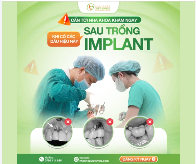 ĐỪNG “TỰ NHỦ” LÀ KHÔNG SAO: 5 DẤU HIỆU CẦN TỚI NHA KHOA KHÁM NGAY SAU CẤY IMPLANT