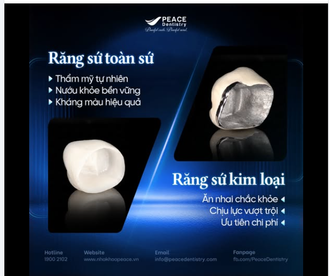 CHỌN RĂNG SỨ SAO CHO ĐÚNG?