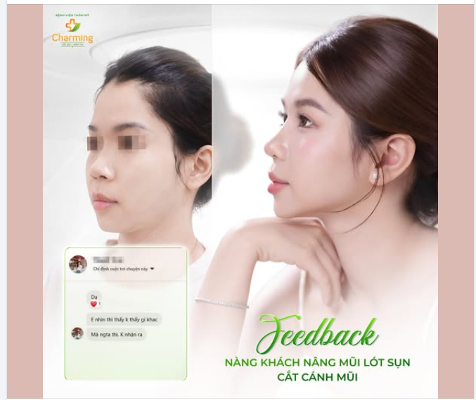 "LẠC LỐI" TRƯỚC GÓC NGHIÊNG CỰC PHẨM CỦA NÀNG THƠ CHARMING SAU NÂNG MŨI!