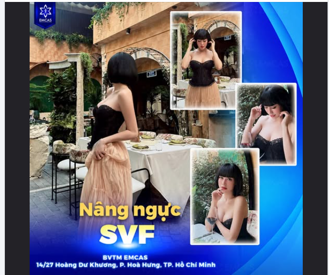 +1 xinh đẹp sau Nâng ngực SVF tại EMCAS