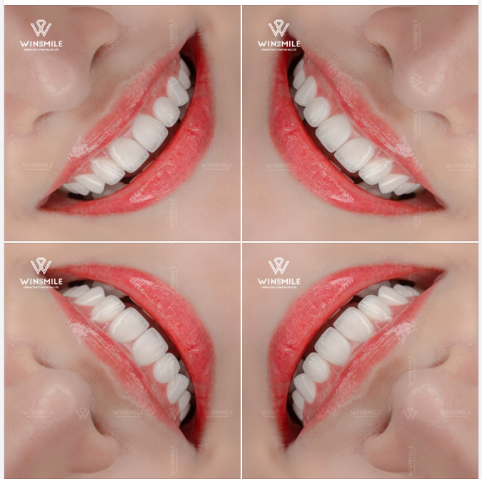 Một nụ cười đẹp không thay đổi con người bạn, mà giúp những nét đẹp vốn có - sự tươi trẻ, nét dịu dàng và niềm vui bên trong - được giải phóng và bộc lộ một cách tự nhiên nhất