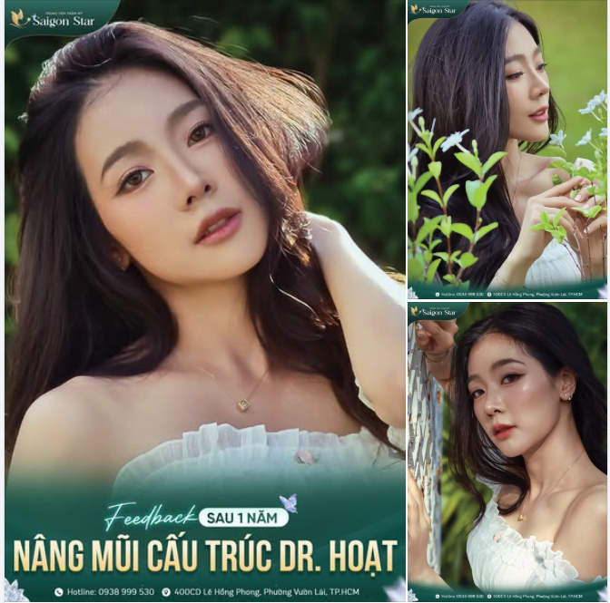 Nhá nhẹ 1 chiếc feedback xinh đẹp của khách hàng sau 1 năm nâng mũi để chị em mình có động lực inbox cho Bác sĩ Hoạt đây!!!