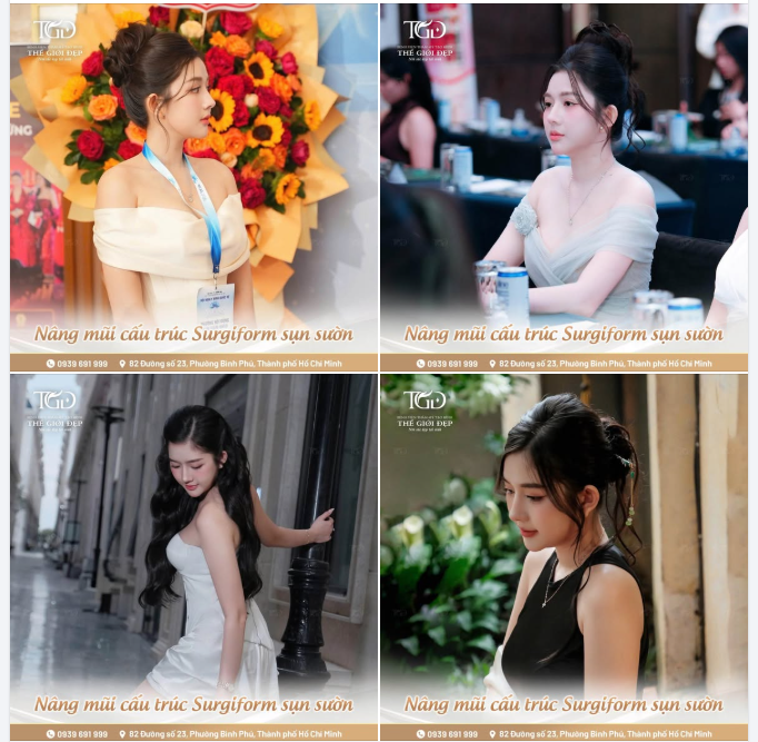 Sau quá trình đánh giá tình trạng hiện tại, tiền sử can thiệp thẩm mỹ của quý Cô. Lựa chọn phù hợp chính là giải pháp tái cấu trúc mũi bằng sụn tự thân và thanh surgiform cao cấp.