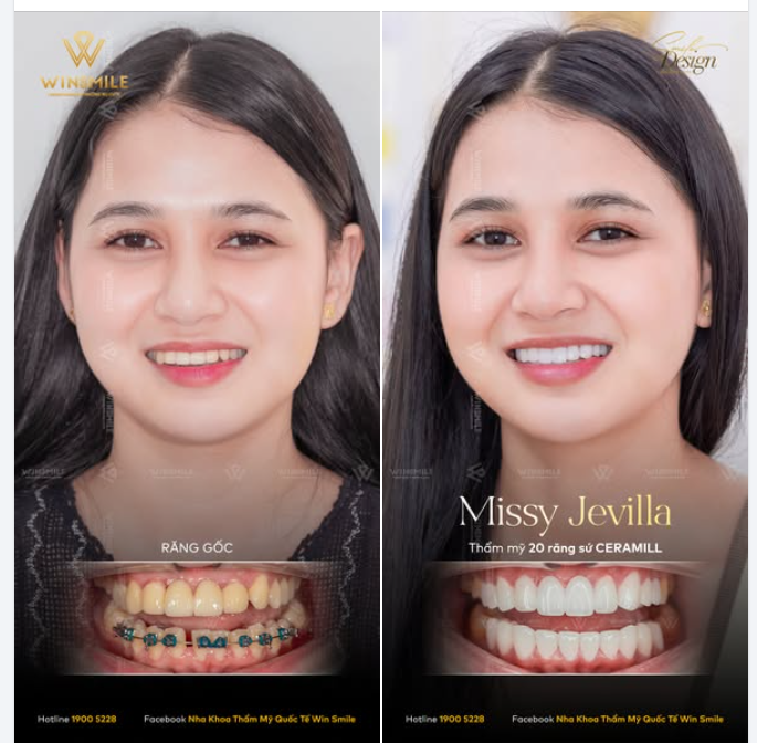 TẠM BIỆT NỤ CƯỜI MỈM VÌ TỰ TI, ĐÓN LẤY NỤ CƯỜI THẬT TƯƠI MÀ MÌNH TỪNG MONG ƯỚC
