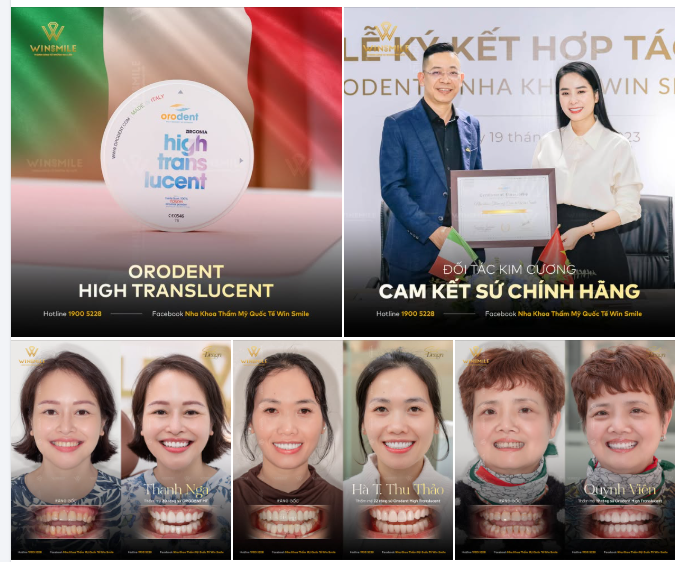 ORODENT HIGH TRANSLUCENT - "ĐIỂM SÁNG" TRONG TRẺO TRÊN MỖI NỤ CƯỜI TẠI WIN SMILE