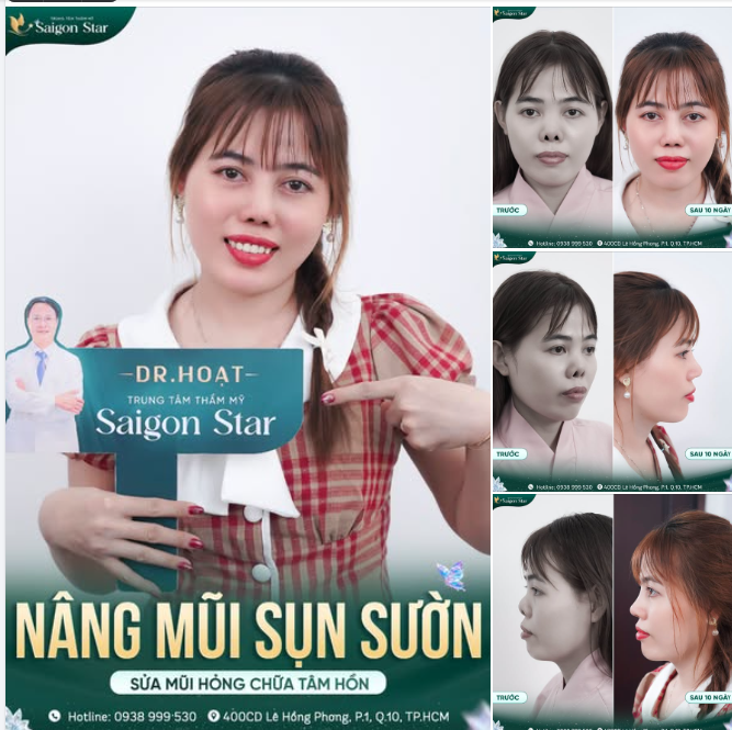 10 NGÀY SỬA LẠI MŨI HỎNG - KHẮC PHỤC MỌI BIẾN CHỨNG