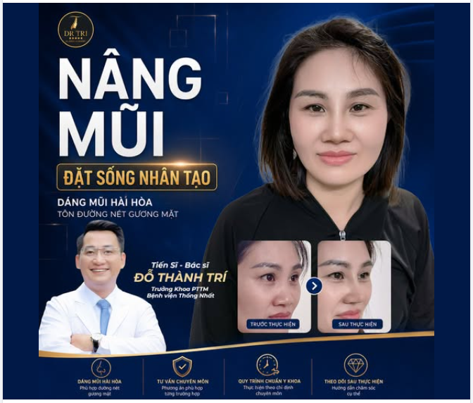 DIỆN MẠO THĂNG HẠNG CHỈ SAU MỘT LẦN NÂNG MŨI