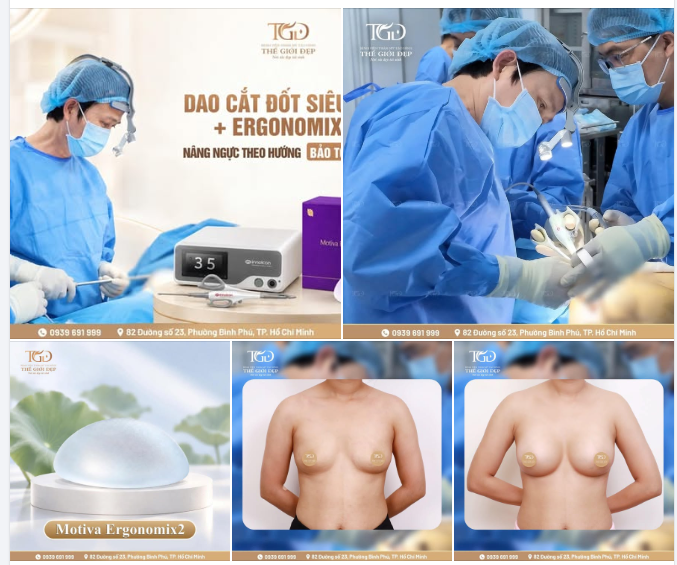 Một vòng một đẹp không chỉ được quyết định bởi kích thước túi ngực mà còn phụ thuộc vào cách tạo khoang, đặc điểm mô và sự hài hòa với vóc dáng cơ thể.