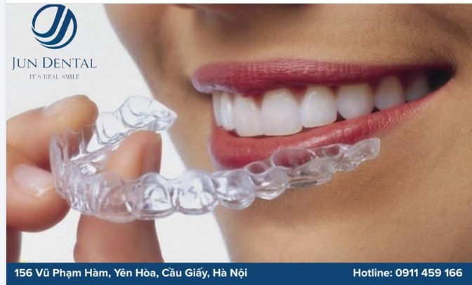 NIỀNG RĂNG TRONG SUỐT – TỰ TIN CẢ HÀNH TRÌNH