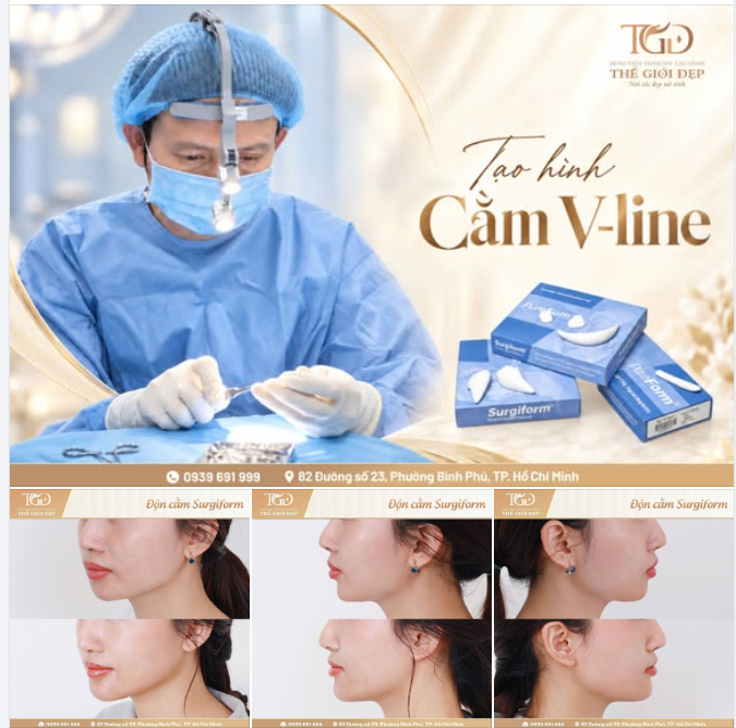 Cằm lồi lõm do filler – Tái tạo dáng cằm chuẩn V.line bằng sụn sinh học cao cấp Surgiform