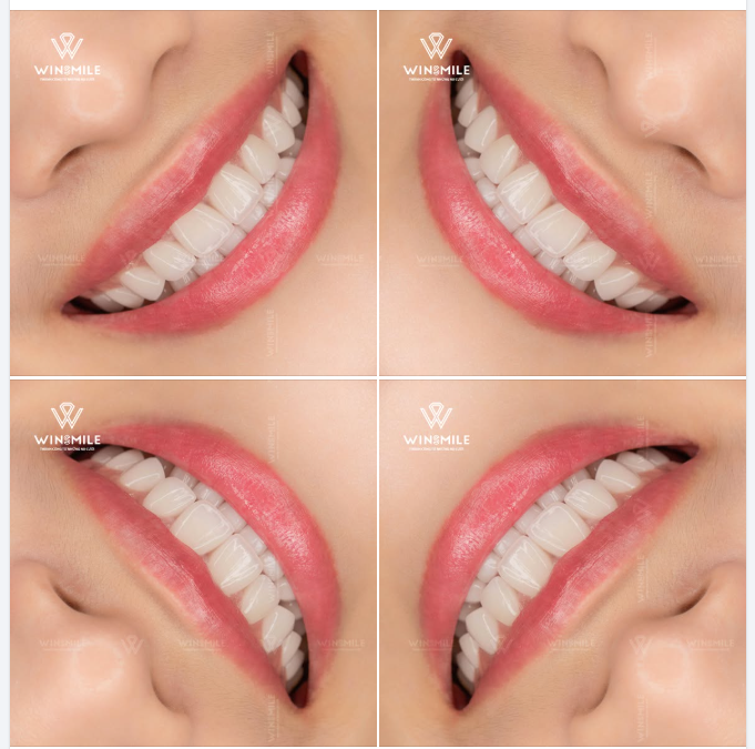Với chị Thùy An, lựa chọn dáng Oval mang đến một diện mạo nhẹ nhàng và tinh tế.