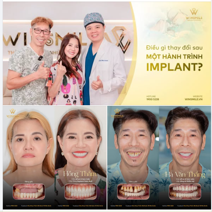 ĐIỀU GÌ THAY ĐỔI SAU MỘT HÀNH TRÌNH IMPLANT?