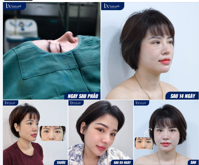 BẠN CÓ ĐOÁN ĐƯỢC CHỊ KHÁCH ĐÃ "THAY ÁO MỚI" CHO NHỮNG ĐƯỜNG NÉT NÀO KHÔNG?