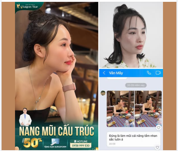 FEEDBACK THAY DÁNG MŨI NÂNG TẦM NHAN SẮC