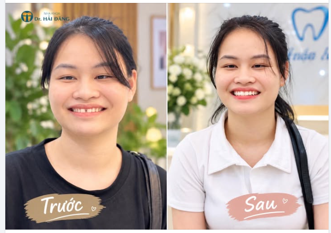 NỤ CƯỜI THAY ĐỔI – THẦN THÁI CŨNG KHÁC!