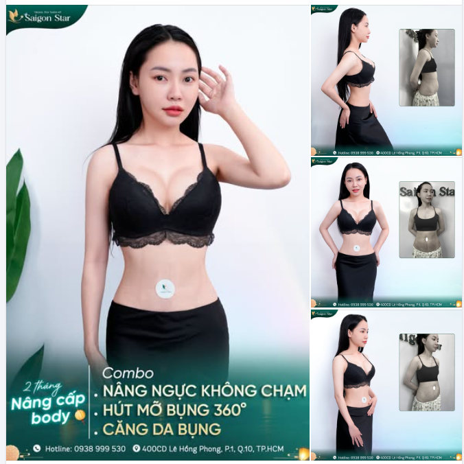 Diễm Phạm chia sẻ sau 2 tháng nâng cấp body với "combo hot" NÂNG NGỰC KHÔNG CHẠM + HÚT MỠ BỤNG 360° + CĂNG DA BỤNG tại Saigon Star.