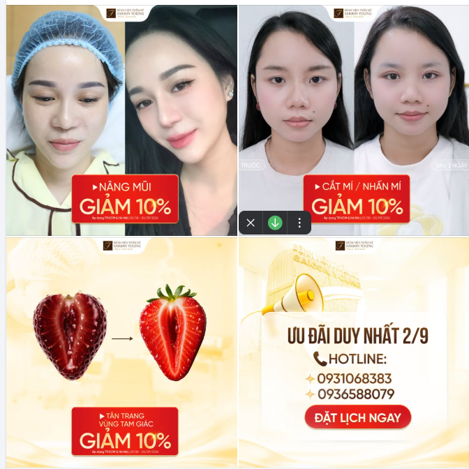 LỄ NÀY ĐẾN NGAY SAIGON YOUNG NHẬN ƯU ĐÃI TẤT CẢ DỊCH VỤ NÂNG CẤP NHAN SẮC