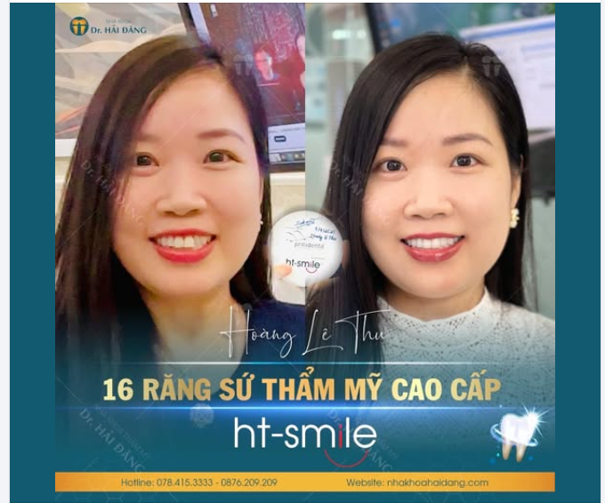 THAY ĐỔI NỤ CƯỜI – NÂNG TẦM THẦN THÁI