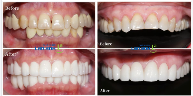 HƠN 20 NĂM CHĂM SÓC NỤ CƯỜI TẠI PHÚ NHUẬN