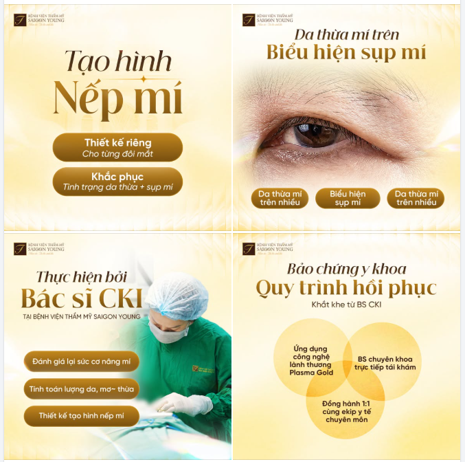 TẠO HÌNH NẾP MÍ: AN TOÀN - VỪA VẶN - TỰ NHIÊN