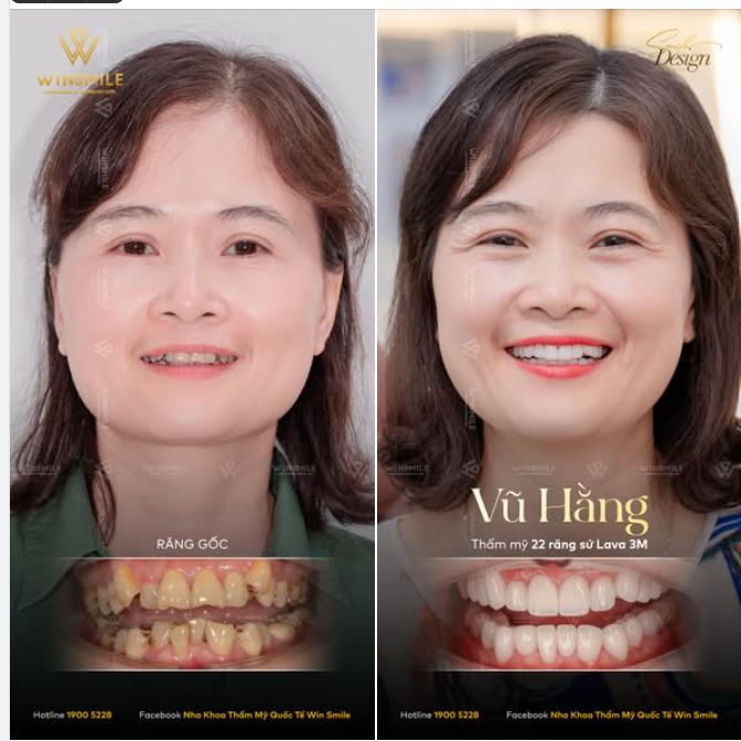 "ĐẾN GIỜ CHỊ VẪN CHƯA TIN MÌNH CÓ NỤ CƯỜI ĐẸP NHƯ THẾ"