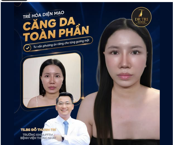 HỒI SINH NÉT XUÂN VỚI CĂNG DA TOÀN PHẦN CÙNG TS.BS ĐỖ THÀNH TRÍ