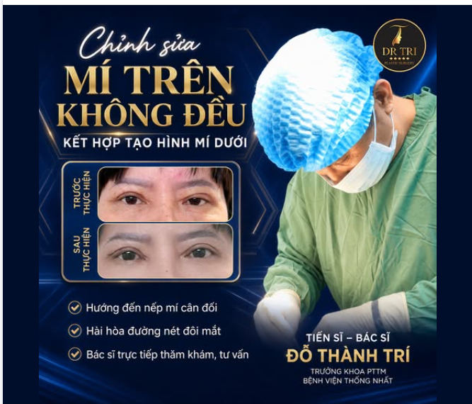 BÍ QUYẾT SỞ HỮU ĐÔI MẮT RẠNG NGỜI CÙNG DR. TRÍ