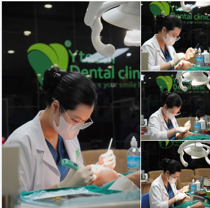 Răng cửa lệch lạc có nhất thiết phải nhổ răng để kéo đều không?