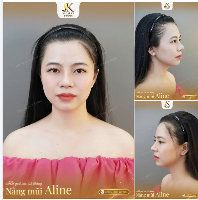 ĐẸP NHẸ NHÀNG – THẦN THÁI THĂNG HẠNG
