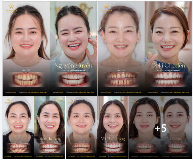 1000+ KHÁCH HÀNG THỰC TẾ TẠI WIN SMILE