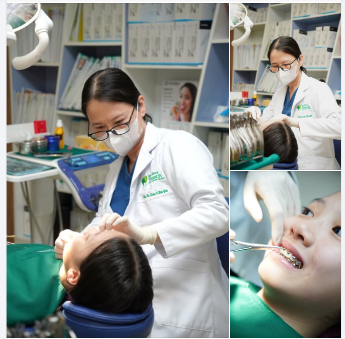  “Răng em khấp khểnh, niềng răng có bắt buộc phải nhổ không?”