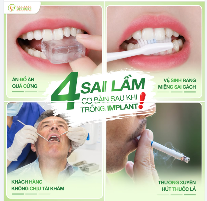 4 SAI LẦM CƠ BẢN SAU KHI TRỒNG IMPLANT