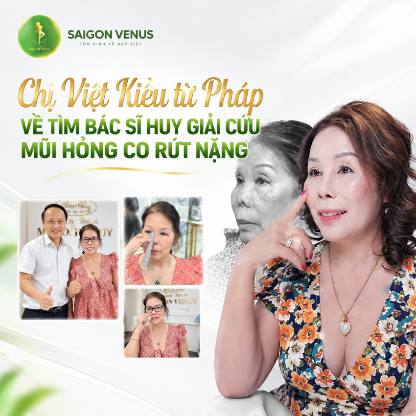 CHỊ VIỆT KIỀU TỪ PHÁP VỀ TÌM BÁC SĨ HUY GIẢI MŨI MŨI HỎNG CO RÚT NẶNG